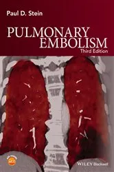 Book cover of Pulmonary Embolism (3rd ed.) by Paul D. Stein