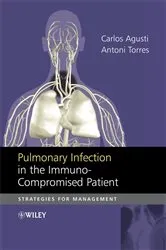 Book cover of Pulmonary Infection in the Immunocompromised Patient by Carlos Agusti