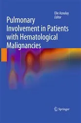 Book cover of Pulmonary Involvement in Patients with Hematological Malignancies by Unknown
