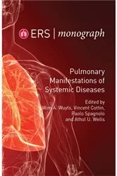 Book cover of Pulmonary Manifestations of Systemic Diseases by Wim A. Wuyts