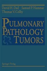 Book cover of Pulmonary Pathology — Tumors by David H. Dail