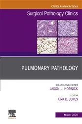 Book cover of Pulmonary Pathology,An Issue of Surgical Pathology Clinics by Kirk Jones