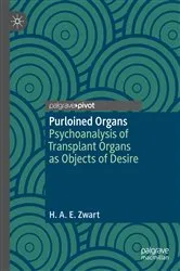 Book cover of Purloined Organs by Unknown
