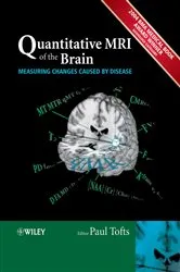 Book cover of Quantitative MRI of the Brain by Paul Tofts