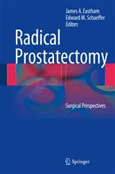 Book cover of Radical Prostatectomy by Unknown
