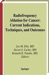 Book cover of Radiofrequency Ablation for Cancer by Lee M. Ellis