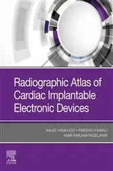 Book cover of Radiographic Atlas of Cardiac Implantable Electronic Devices - E-Book by Haghjoo MD, FESC, FACC, Majid