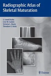 Book cover of Radiographic Atlas of Skeletal Maturation by S. Lowell Kahn