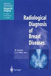 Book cover of Radiological Diagnosis of Breast Diseases by Michael Friedrich