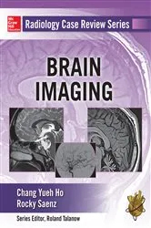 Book cover of Radiology Case Review Series: Brain Imaging by Chang Ho
