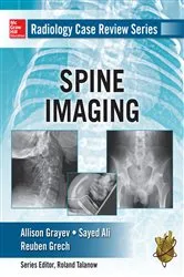 Book cover of Radiology Case Review Series: Spine by Allison Michele Grayev