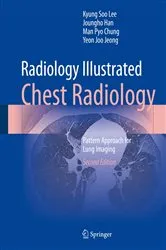 Book cover of Radiology Illustrated: Chest Radiology (2nd ed.) by Kyung Soo Lee