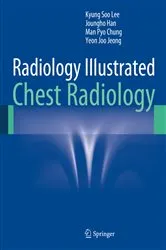 Book cover of Radiology Illustrated: Chest Radiology by Kyung Soo Lee