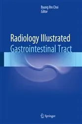 Book cover of Radiology Illustrated: Gastrointestinal Tract by Byung Ihn Choi