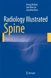 Book cover of Radiology Illustrated: Spine by Heung Sik Kang