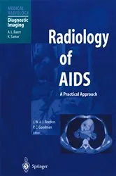 Book cover of Radiology of AIDS by J.W.A.J. Reeders