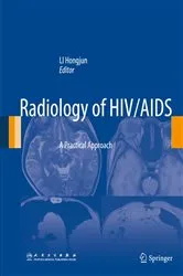 Book cover of Radiology of HIV/AIDS by Hongjun Li