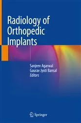 Book cover of Radiology of Orthopedic Implants by Sanjeev Agarwal
