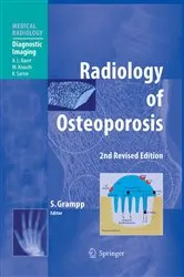 Book cover of Radiology of Osteoporosis (2nd ed.) by Stephan Grampp