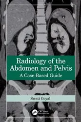 Book cover of Radiology of the Abdomen and Pelvis by Swati Goyal