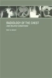 Book cover of Radiology of the Chest and Related Conditions by Unknown