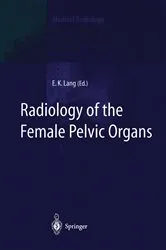 Book cover of Radiology of the Female Pelvic Organs by Erich K. Lang