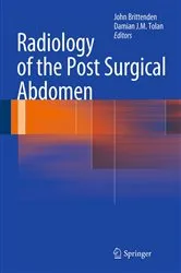Book cover of Radiology of the Post Surgical Abdomen by John Brittenden