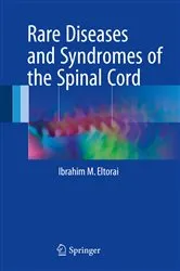 Book cover of Rare Diseases and Syndromes of the Spinal Cord by Unknown