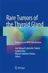 Book cover of Rare Tumors of the Thyroid Gland by José Manuel Cameselle-Teijeiro