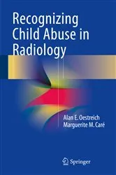 Book cover of Recognizing Child Abuse in Radiology by Alan E. Oestreich