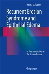 Book cover of Recurrent Erosion Syndrome and Epithelial Edema by Helena M. Tabery