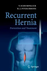 Book cover of Recurrent Hernia by Volker Schumpelick