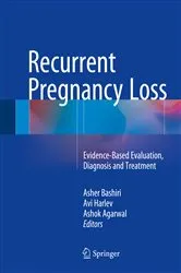 Book cover of Recurrent Pregnancy Loss by Asher Bashiri