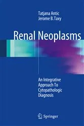 Book cover of Renal Neoplasms by Unknown