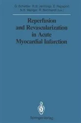 Book cover of Reperfusion and Revascularization in Acute Myocardial Infarction by Gotthard Schettler