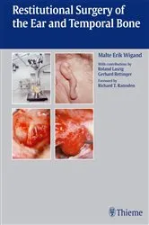 Book cover of Restitutional Surgery of the Ear and Temporal Bone by Malte Erik Wigand