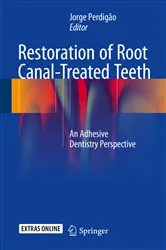 Book cover of Restoration of Root Canal-Treated Teeth by Jorge Perdigão