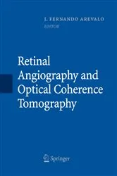 Book cover of Retinal Angiography and Optical Coherence Tomography by J. Fernando Arévalo