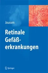 Book cover of Retinale Gefäßerkrankungen by Antonia Joussen
