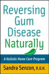Book cover of Reversing Gum Disease Naturally by Unknown