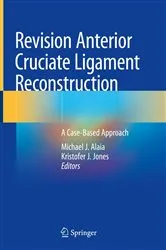 Book cover of Revision Anterior Cruciate Ligament Reconstruction by Michael J. Alaia