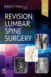 Book cover of Revision Lumbar Spine Surgery E-Book by Robert F. Heary MD