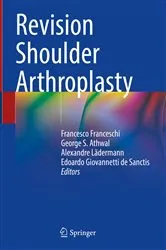 Book cover of Revision Shoulder Arthroplasty by Francesco Franceschi