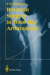 Book cover of Revision Surgery in Total Hip Arthroplasty by Boguslaw M. Wroblewski