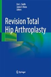 Book cover of Revision Total Hip Arthroplasty by Eric L. Smith