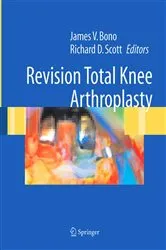 Book cover of Revision Total Knee Arthroplasty by James V. Bono