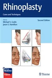 Book cover of Rhinoplasty (2nd ed.) by Michael S. Godin