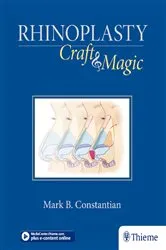 Book cover of Rhinoplasty by Mark Constantian