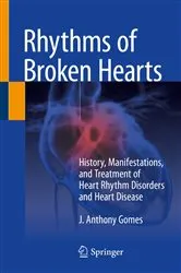 Book cover of Rhythms of Broken Hearts by J. Anthony Gomes