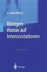 Book cover of Röntgenthorax auf Intensivstationen by Unknown